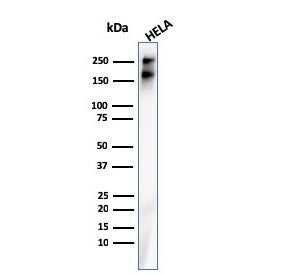 Western blot testing of human HeLa cell lysate with recombinant Spectrin beta III antibody. Predicted molecular weight ~246 kDa.