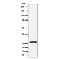 Western blot testing of human HepG2 cell lysate with Adenylate kinase 2 antibody. Predicted molecular weight ~26 kDa.