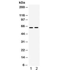 Western blot testing of human 1) A549 and 2) HeLa lysate with LOXL1 antibody. Expected/observed molecular weight ~63 kDa.