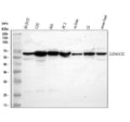 Western blot analysis of LINGO2 using anti-LINGO2 antibody. Lane 1: human SH-SY5Y whole cell lysates, Lane 2: human U251 whole cell lysates, Lane 3: human Hela whole cell lysates, Lane 4: human PC-3 whole cell lysates, Lane 5: rat brain tissue lysates, Lane 6: rat C6 whole cell lysates, Lane 7: mouse brain tissue lysates. After electrophoresis, proteins were transferred to a nitrocellulose membrane at 150 mA for 50-90 min. Blocked the membrane with 5% non-fat milk/TBS for 1.5 hour at RT.