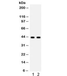 Western blot testing of 1) rat skeletal muscle and 2) mouse skeletal muscle lysate with SGCA antibody. Predicted molecular weight: 43~50 kDa.