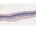IHC testing of FFPE human retinal with CNGB3 antibody at 2ug/ml. Staining of the pigmented epithelial cells is seen.