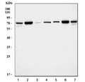 Western blot testing of 1) rat brain, 2) rat kidney, 3) rat spleen, 4) rat liver, 5) mouse brain, 6) mouse kidney and 7) mouse liver tissue lysate with SDHA antibody. Predicted molecular weight: 57-73 kDa (multiple isoforms).