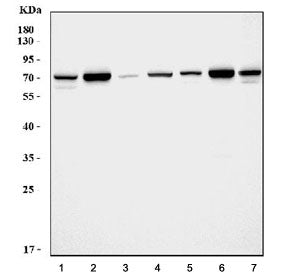Western blot testing of 1) rat brain, 2) rat kidney, 3) rat spleen, 4) rat liver, 5) mouse brain, 6) mouse kidney and 7) mouse liver tissue lysate with SDHA antibody. Predicted molecular weight: 57-73 kDa (multiple isoforms).