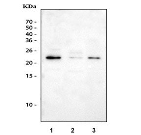 Western blot testing of 1) human A549, 2) rat testis and 3) mouse testis tissue lysate with Gremlin 1 antibody. Expected molecular weight 21~23 kDa.