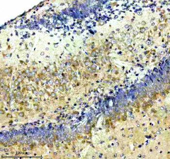 Immunohistochemical staining of NCDN using anti-NCDN antibody. NCDN was detected in a paraffin-embedded section of mouse brain tissue. Heat mediated antigen retrieval was performed in EDTA buffer (pH 8.0, epitope retrieval solution). The tissue section was blocked with 10% goat serum. The tissue section was then incubated with 2 ug/ml rabbit anti-NCDN antibody overnight at 4oC. Peroxidase Conjugated Goat Anti-rabbit IgG was used as secondary antibody and incubated for 30 min at 37oC.