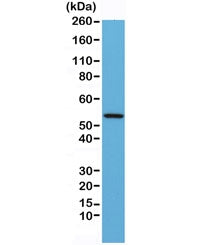 Western blot testing of mouse heart lysate with recombinant Desmin antibody at 1:1000. Predicted molecular weight ~54 kDa.