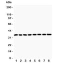 Western blot testing of Cyclin D3 antibody and Lane 1: rat testis; 2: (r) thymus; 3: (r) lung; 4: (r) ovary; 5: human Jurkat; 6: (h) A549; 7: (h) MCF-7; 8: (h) HeLa lysate. Predicted molecular weight ~33 kDa.