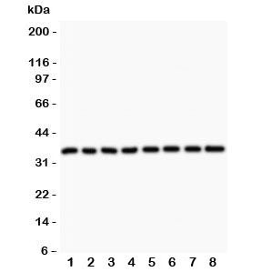 Western blot testing of Cyclin D3 antibody and Lane 1: rat testis; 2: (r) thymus; 3: (r) lung; 4: (r) ovary; 5: human Jurkat; 6: (h) A549; 7: (h) MCF-7; 8: (h) HeLa lysate. Predicted molecular weight ~33 kDa.