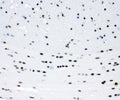 IHC staining of FFPE mouse brain tissue with SIP1 antibody. HIER: boil tissue sections in pH6 citrate buffer for 20 min and allow to cool before testing.
