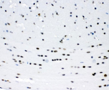 IHC staining of FFPE mouse brain tissue with SIP1 antibody. HIER: boil tissue sections in pH6 citrate buffer for 20 min and allow to cool before testing.