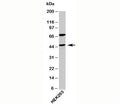 Western blot testing of human samples with ATG4B antibody at 4ug/ml.