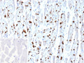 IHC staining of FFPE human heart tissue with Cadherin 2 antibody (clone CDH2/9494). Inset: PBS used in place of primary Ab (secondary Ab negative control). HIER: boil tissue sections in pH 9 10mM Tris with 1mM EDTA for 20 min and allow to cool before testing.