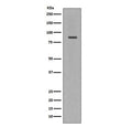 Western blot testing of human Jukat cell lysate with Cleaved PARP antibody. Predicted molecular weight ~89 kDa (auto-modification/catalytic domain).