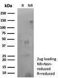 SDS-PAGE analysis of purified, BSA-free CD274 antibody (clone rPDL1/8825) as confirmation of integrity and purity.
