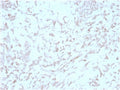 IHC staining of FFPE human liver tissue with Kindlin 2 antibody (clone 3A3). HIER: boil tissue sections in pH 9 10mM Tris with 1mM EDTA for 20 min and allow to cool before testing.