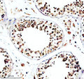 Immunohistochemical staining of TFDP3 using anti-TFDP3 antibody. TFDP3 was detected in a paraffin-embedded section of human testis tissue. Heat mediated antigen retrieval was performed in EDTA buffer (pH 8.0, epitope retrieval solution). The tissue section was blocked with 10% goat serum. The tissue section was then incubated with 2 ug/ml rabbit anti-TFDP3 antibody overnight at 4oC. Peroxidase Conjugated Goat Anti-rabbit IgG was used as secondary antibody and incubated for 30 min at 37oC.
