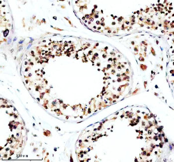 Immunohistochemical staining of TFDP3 using anti-TFDP3 antibody. TFDP3 was detected in a paraffin-embedded section of human testis tissue. Heat mediated antigen retrieval was performed in EDTA buffer (pH 8.0, epitope retrieval solution). The tissue section was blocked with 10% goat serum. The tissue section was then incubated with 2 ug/ml rabbit anti-TFDP3 antibody overnight at 4oC. Peroxidase Conjugated Goat Anti-rabbit IgG was used as secondary antibody and incubated for 30 min at 37oC.