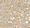 Immunohistochemical staining of FGL1 using anti-FGL1 antibody. FGL1 was detected in a paraffin-embedded section of human liver tissue. Heat mediated antigen retrieval was performed in EDTA buffer (pH 8.0, epitope retrieval solution). The tissue section was blocked with 10% goat serum. The tissue section was then incubated with 2 ug/ml rabbit anti-FGL1 antibody overnight at 4oC. Peroxidase Conjugated Goat Anti-rabbit IgG was used as secondary antibody and incubated for 30 min at 37oC.