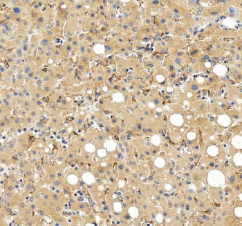 Immunohistochemical staining of FGL1 using anti-FGL1 antibody. FGL1 was detected in a paraffin-embedded section of human liver tissue. Heat mediated antigen retrieval was performed in EDTA buffer (pH 8.0, epitope retrieval solution). The tissue section was blocked with 10% goat serum. The tissue section was then incubated with 2 ug/ml rabbit anti-FGL1 antibody overnight at 4oC. Peroxidase Conjugated Goat Anti-rabbit IgG was used as secondary antibody and incubated for 30 min at 37oC.