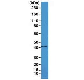 Western blot testing of mouse heart lysate with recombinant ACTA2 antibody at 1:1000. Predicted molecular weight ~42 kDa.