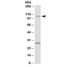 Western blot testing of NIH3T3 lysate with Myo1H antibody at 0.1ug/ml. The expected ~110 kDa band and the additional ~28 kDa band are both blocked by the immunizing peptide.