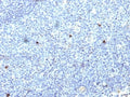 IHC: Formalin-fixed, paraffin-embedded human tonsil stained with HLA-Aw32 / HLA-A25 antibody (SPM418).