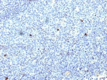 IHC: Formalin-fixed, paraffin-embedded human tonsil stained with HLA-Aw32 / HLA-A25 antibody (SPM418).