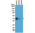 Western blot testing of human tumor cell line lysate with recombinant PD-L1 antibody at 1:1000. DU145 and LNCaP are prostate cancer cell lines with very minor PD-L1 expression. Predicted molecular weight ~34 kDa (unmodified), 45-70 kDa (glycosylated).