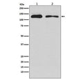 Western blot testing of 1) human HEK293 and 2) rat PC-12 cell lysate with ULK1 antibody. Predicted molecular weight: 112-150 kDa.