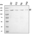 Western blot analysis of KIF7 using anti-KIF7 antibody. Lane 1: human 293T whole cell lysates, Lane 2: human whole cell lysates, Lane 3: human Hela whole cell lysates, Lane 4: human Jurkat whole cell lysates. After electrophoresis, proteins were transferred to a nitrocellulose membrane at 150 mA for 50-90 min. Blocked the membrane with 5% non-fat milk/TBS for 1.5 hour at RT.