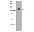 Western blot testing of mouse heart lysate with Neuropilin 1 antibody. Expected molecular weight: 102-130 kDa.