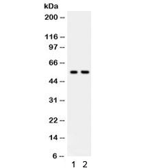Western blot testing of human 1) HeLa and 2) Jurkat lysate with TRAF2 antibody. Predicted/expected molecular weight ~56 kDa.