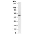 Western blot testing of human testis lysate with LCAT antibody at 1ug/ml. Observed molecular weight: 50~75 kDa depending on glycosylation level.