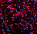 Immunofluorescent staining of TDP1 using anti-TDP1 antibody (red). TDP1 was detected in a paraffin-embedded section of mouse brain tissue. Heat mediated antigen retrieval was performed in EDTA buffer (pH 8.0, epitope retrieval solution). The tissue section was blocked with 10% goat serum. The tissue section was then incubated with 5 ug/ml rabbit anti-TDP1 antibody overnight at 4oC. Cy3 Conjugated Goat Anti-Rabbit IgG was used as secondary antibody at 1:500 dilution and incubated for 30 min at 37oC.