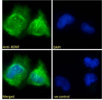 Immunofluorescent staining of fixed and permeabilized human U-251 cells with BDNF antibody (green) at 10ug/ml and DAPI nuclear stain.