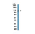 Western blot testing of human small intestine tissue with recombinant DOG1 antibody at 1:200 dilution. Expected molecular weight 74-114 kDa but may be observed at higher molecular weights due to glycosylation.