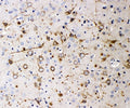 IHC-P: Neurofilament 200 antibody testing of rat brain tissue. HIER: steamed with pH6 citrate buffer.