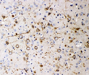 IHC-P: Neurofilament 200 antibody testing of rat brain tissue. HIER: steamed with pH6 citrate buffer.