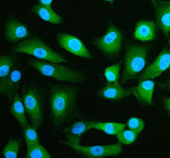 Immunofluorescent staining of SPRED1 using anti-SPRED1 antibody (green). SPRED1 was detected in an immunocytochemical section of cells. Enzyme antigen retrieval was performed using IHC enzyme antigen retrieval reagent for 15 mins. The cells were blocked with 10% goat serum. And then incubated with 5 ug/ml rabbit anti-SPRED1 antibody overnight at 4oC. DyLight 488 Conjugated Goat Anti-Rabbit IgG was used as secondary antibody at 1:500 dilution and incubated for 30 min at 37oC.