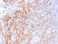 IHC testing of FFPE human tonsil tissue with b-Catenin antibody (clone 6F9). Required HIER: boil tissue sections in 10mM Tris with 1mM EDTA, pH 9.0, for 10-20 min.