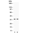 Western blot testing of human 1) HeLa and 2) A549 cell lysate with Livin antibody. Predicted molecular weight: 33/30 kDa (isoforms alpha/beta).