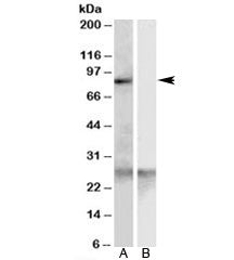 Western blot testing of human heart lysate with SCARF1 antibody at 0.3ug/ml with [B] and without [A] blocking/immunizing peptide. Predicted/observed molecular weight: 87kDa.