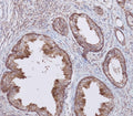 IHC testing of FFPE human prostate tissue with WFDC1 antibody. HIER: steam section in pH9 EDTA for 20 min and allow to cool prior to staining.
