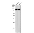 All lanes use the antibody at 1:2000 dilution for 1 hour at room temperature. Western blot analysis of IL12B using anti-IL12B antibody. A strong band is observed at ~75-80 kDa, corresponding to the disulfide-linked homodimer, consistent with reports that the subunit forms stable dimers that migrate above the predicted 37 kDa monomeric size.