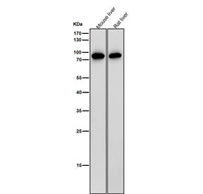 All lanes use the antibody at 1:2000 dilution for 1 hour at room temperature. Western blot analysis of IL12B using anti-IL12B antibody. A strong band is observed at ~75-80 kDa, corresponding to the disulfide-linked homodimer, consistent with reports that the subunit forms stable dimers that migrate above the predicted 37 kDa monomeric size.