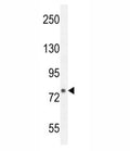 FBXL10b western blot analysis in mouse bladder tissue lysate