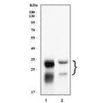Western blot testing of human 1) U-87 MG and 2) HepG2 cell lysate with CTSB antibody. Molecular weight: 38-46 kDa depending on glycosylation level. An ~31 kDa form (propeptide removed) may be observed and may be further processed into an ~25 kDa heavy chain and ~5 kDa light chain.