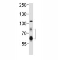 Western blot analysis of lysate from HeLa cell line using PCSK9 antibody. Predicted size: Pro/mature ~74/64 kDa