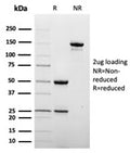 SDS-PAGE analysis of purified, BSA-free CD209 antibody (clone C209/6774) as confirmation of integrity and purity.